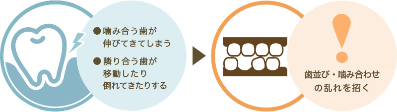 歯が抜けたまま放置してしまうと起こる悪影響