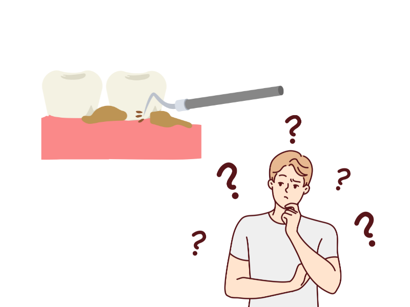 歯医者の歯石除去の重要性｜放置によるリスク