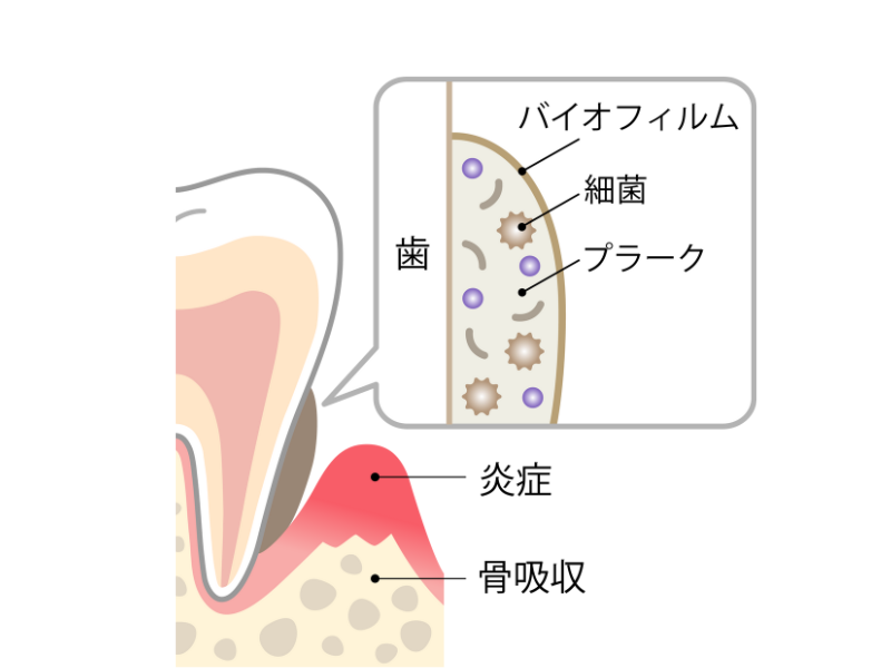 バイオフィルムの形成